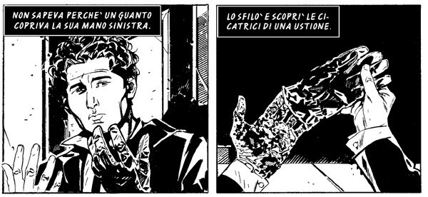 8_ustione